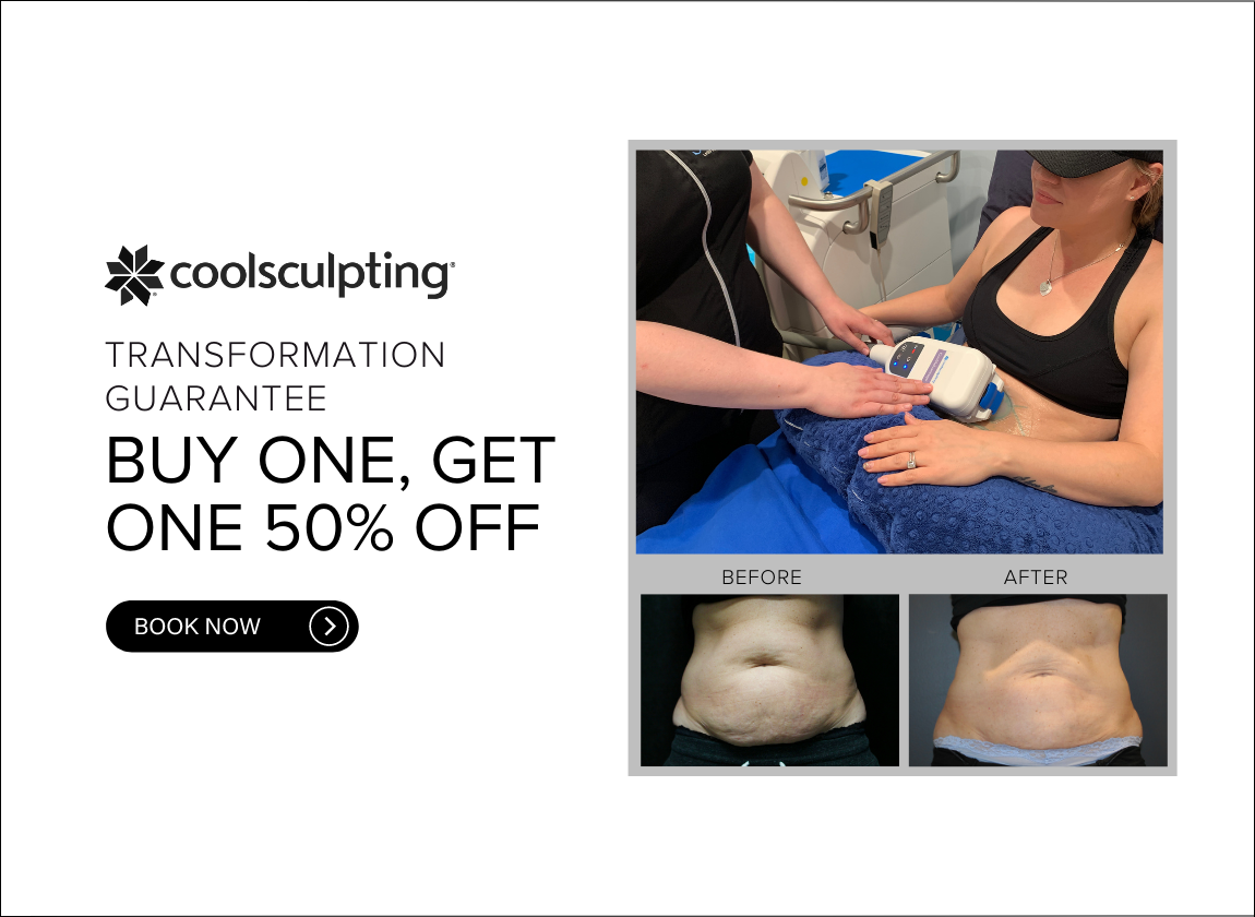 COOLSCULPTING_CALGARY_PROMOTION