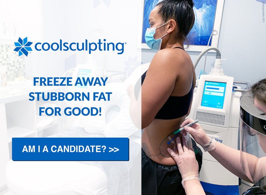 CoolSculpting candidate treatment calgary 