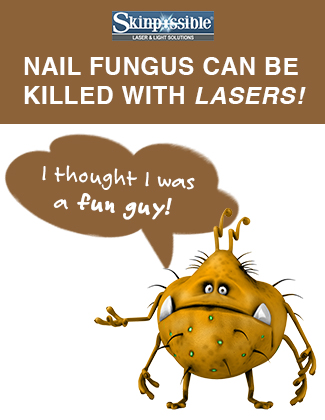 nail fungus2