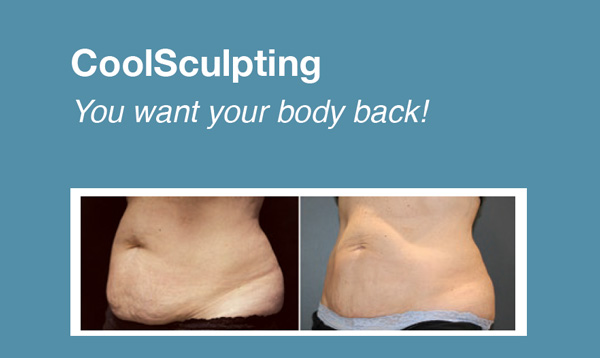 coolsculpting babybelly