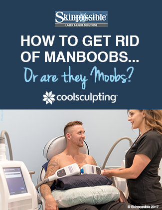 manboobs-coolsculpting-calgary