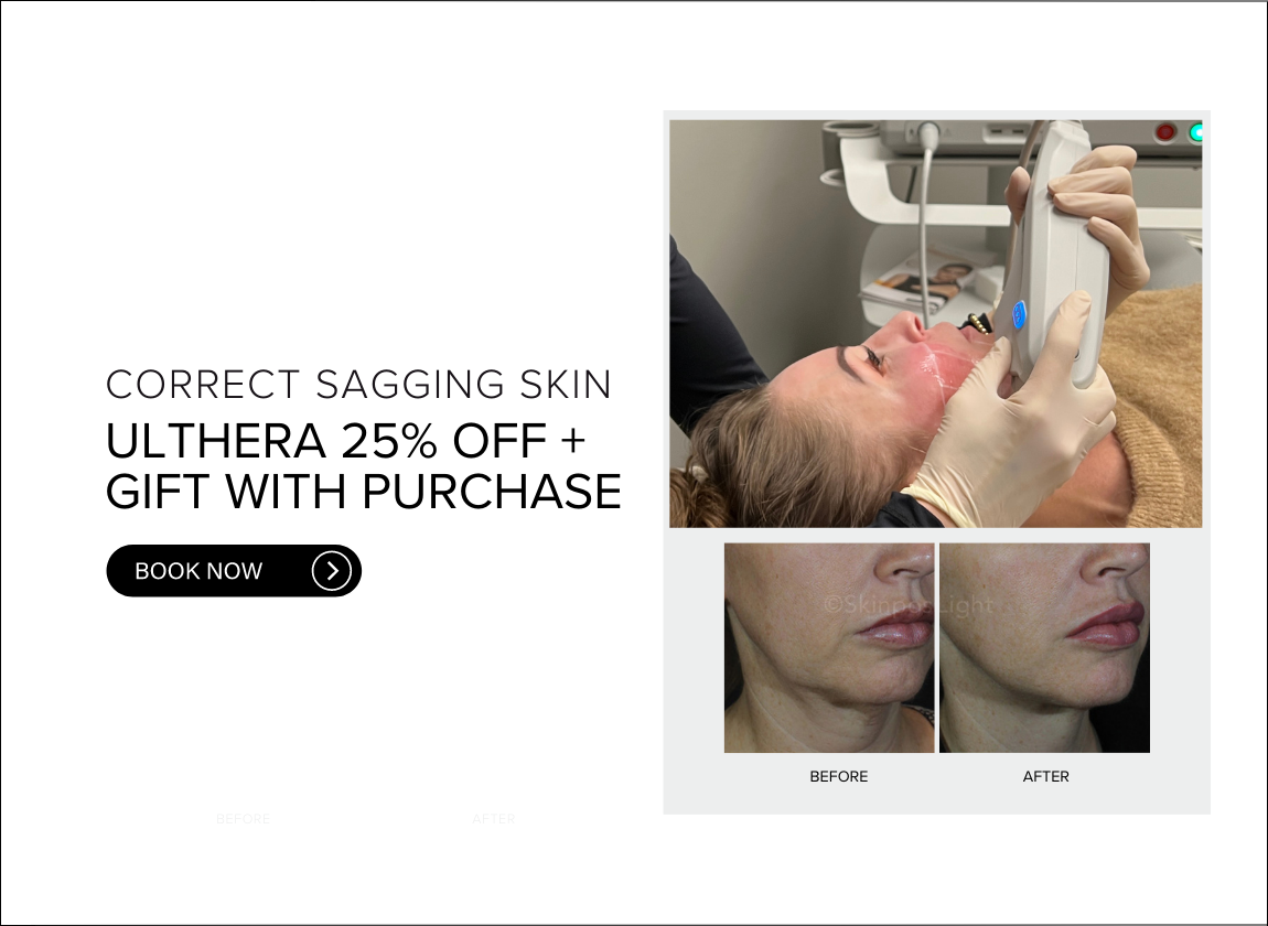 Ultherapy_CALGARY_promotion25off